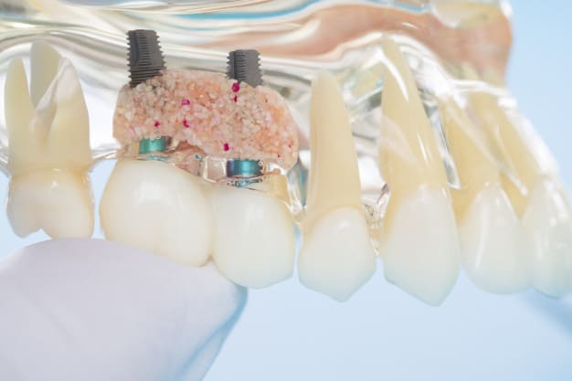 האם מחוסרי עצם יכולים לעבור השתלת שיניים?