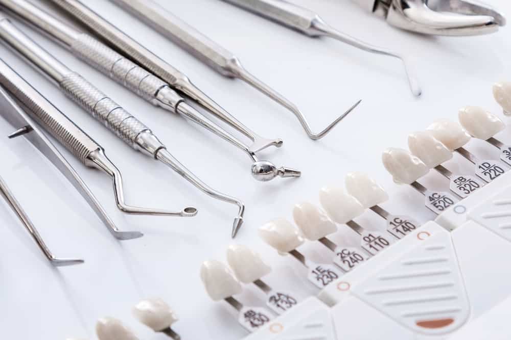 מהו ציפוי שיניים? המדריך המלא
