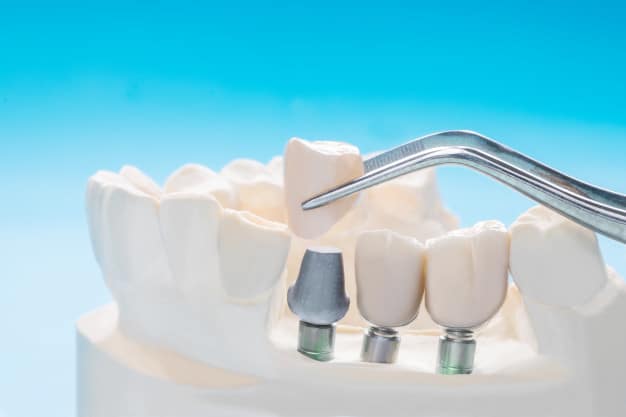 השלמת חוסר שיניים נרחב – אילו שיטות מתאימות?
