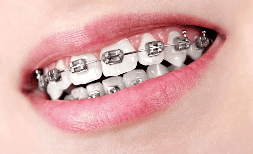 רופא שיניים נווה אפק